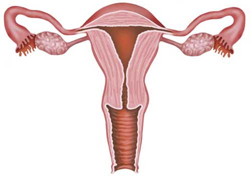 hip replacement diagram